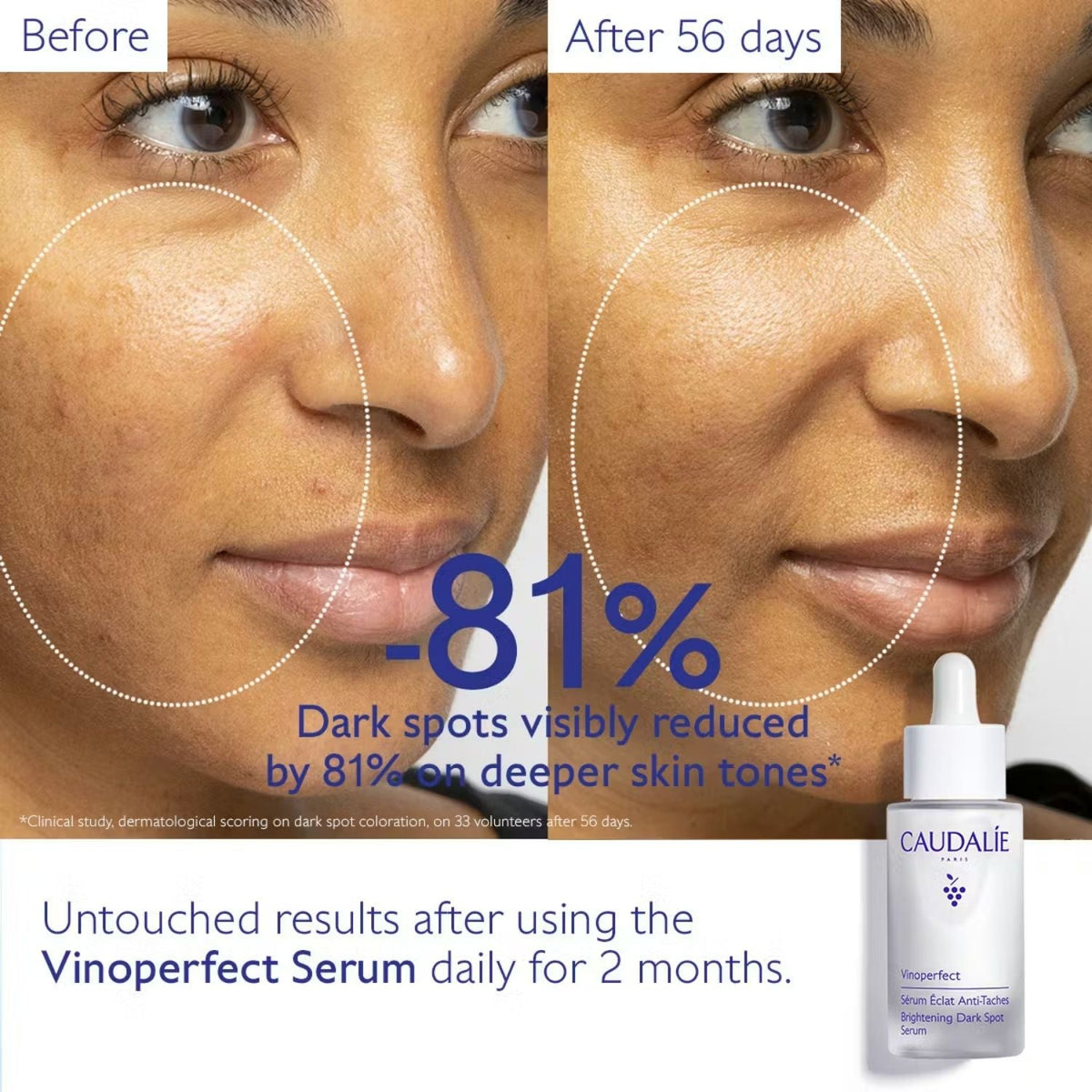Caudalie Vinoperfect Dark Spot Serum 30ml with dropper